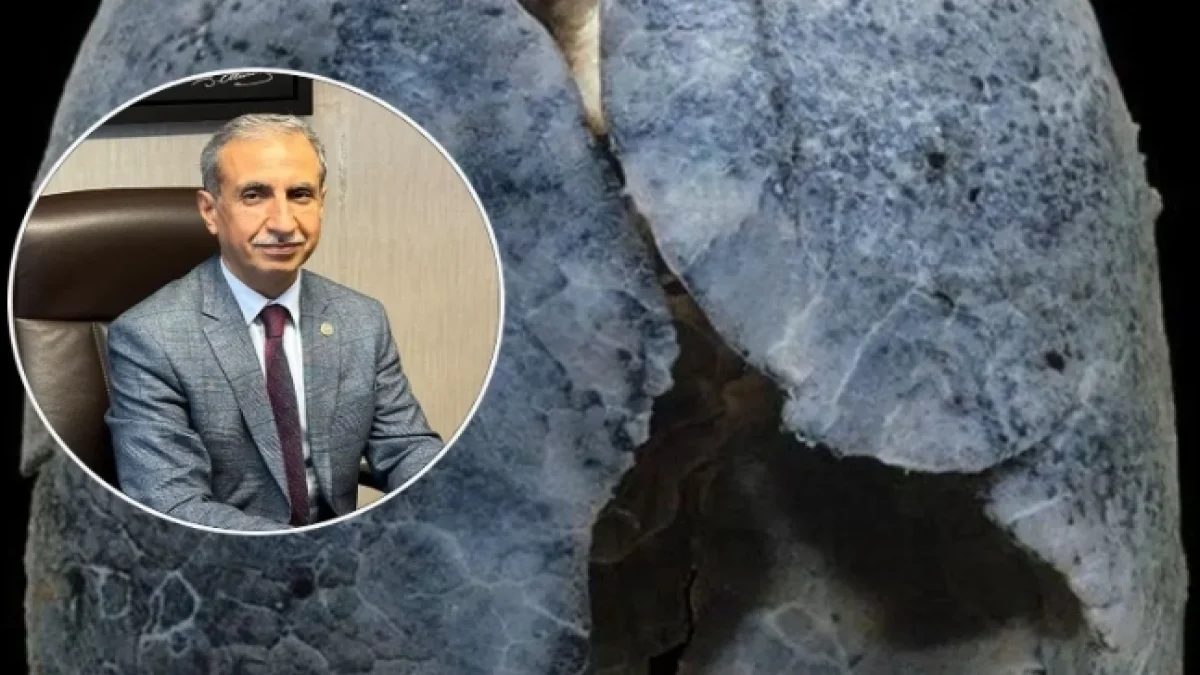 Sağlık Bakanlığı mücadeleyi başlattı! Milletvekili Dusak’tan Destek