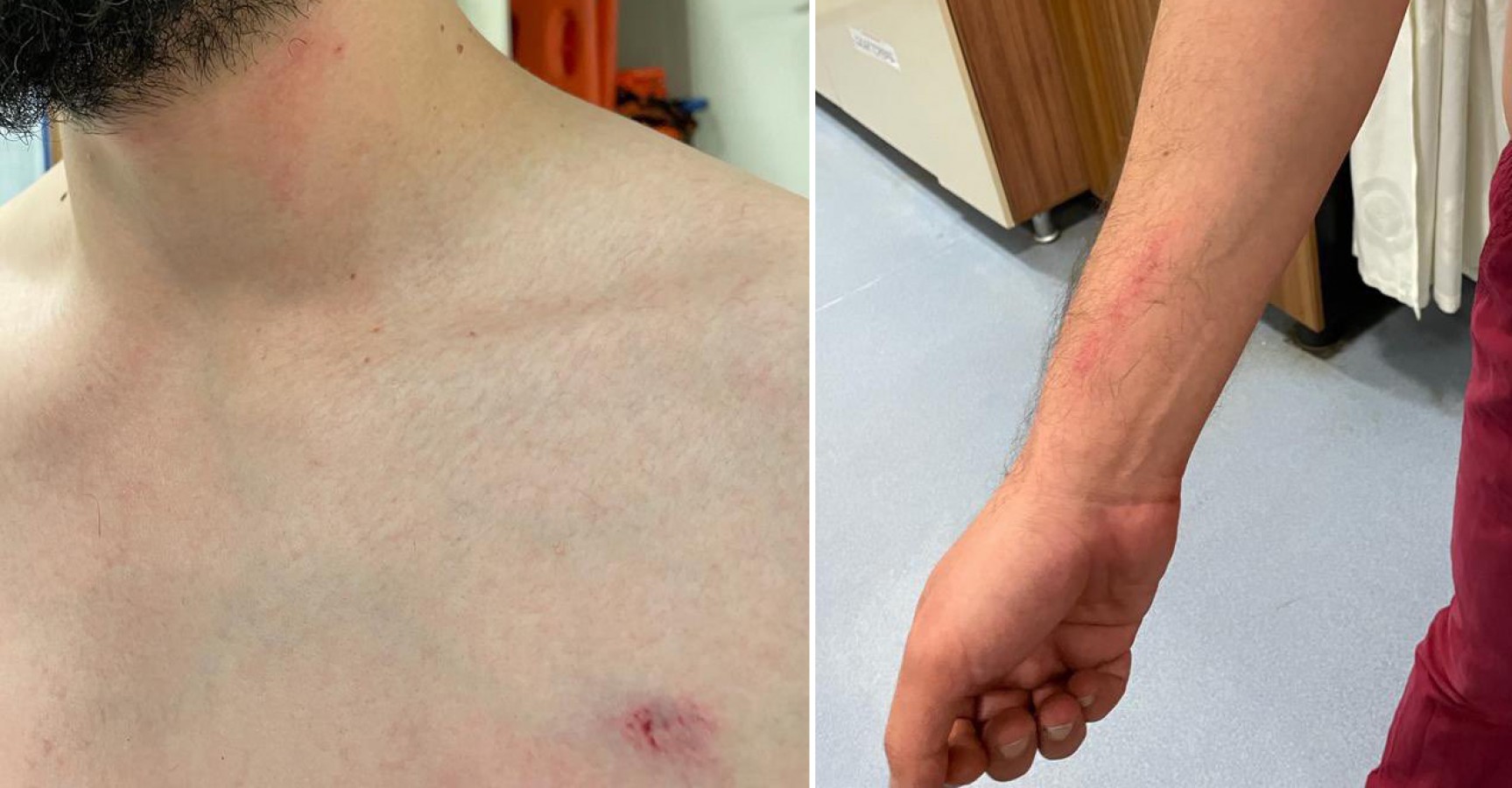 Şanlıurfa'da doktorun darp edilmesine tepki!