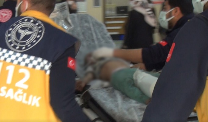 Karaköprü’de ev yangını: 2 ağır yaralı