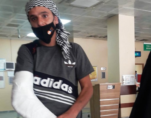 İskeleden düşen işçi yaralandı
