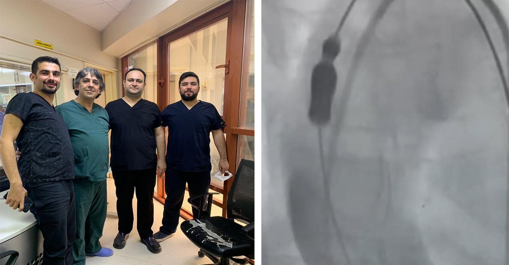 Kalp kapağı, kasık damarından değiştirildi!