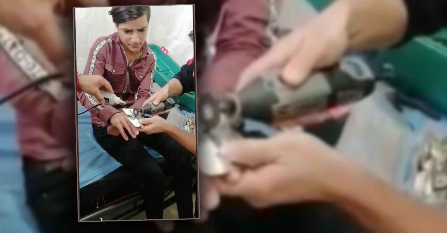 Yüzüğü parmağına sıkışınca yardımına itfaiye yetişti