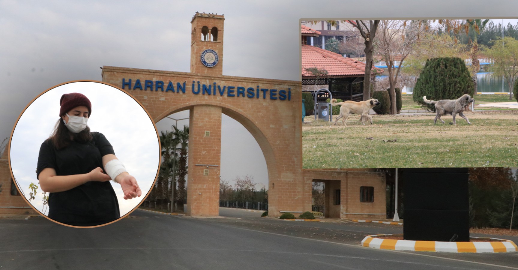 Urfa’da köpeklerin saldırısına uğrayan Rojin, travma yaşıyor