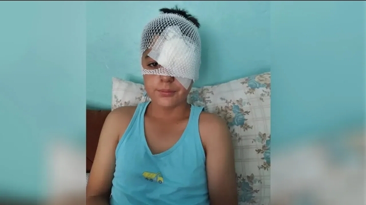 Şanlıurfa'da yine dehşet! Başıboş köpeklerden kaçan çocuğa otomobil çarptı!