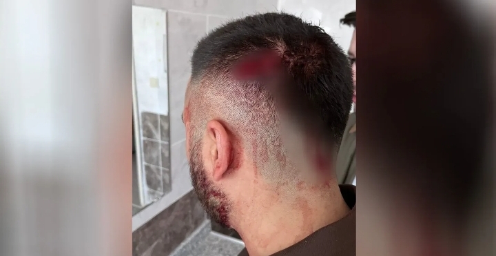 Urfa'da vahşet! Öğretmen darp edildi!