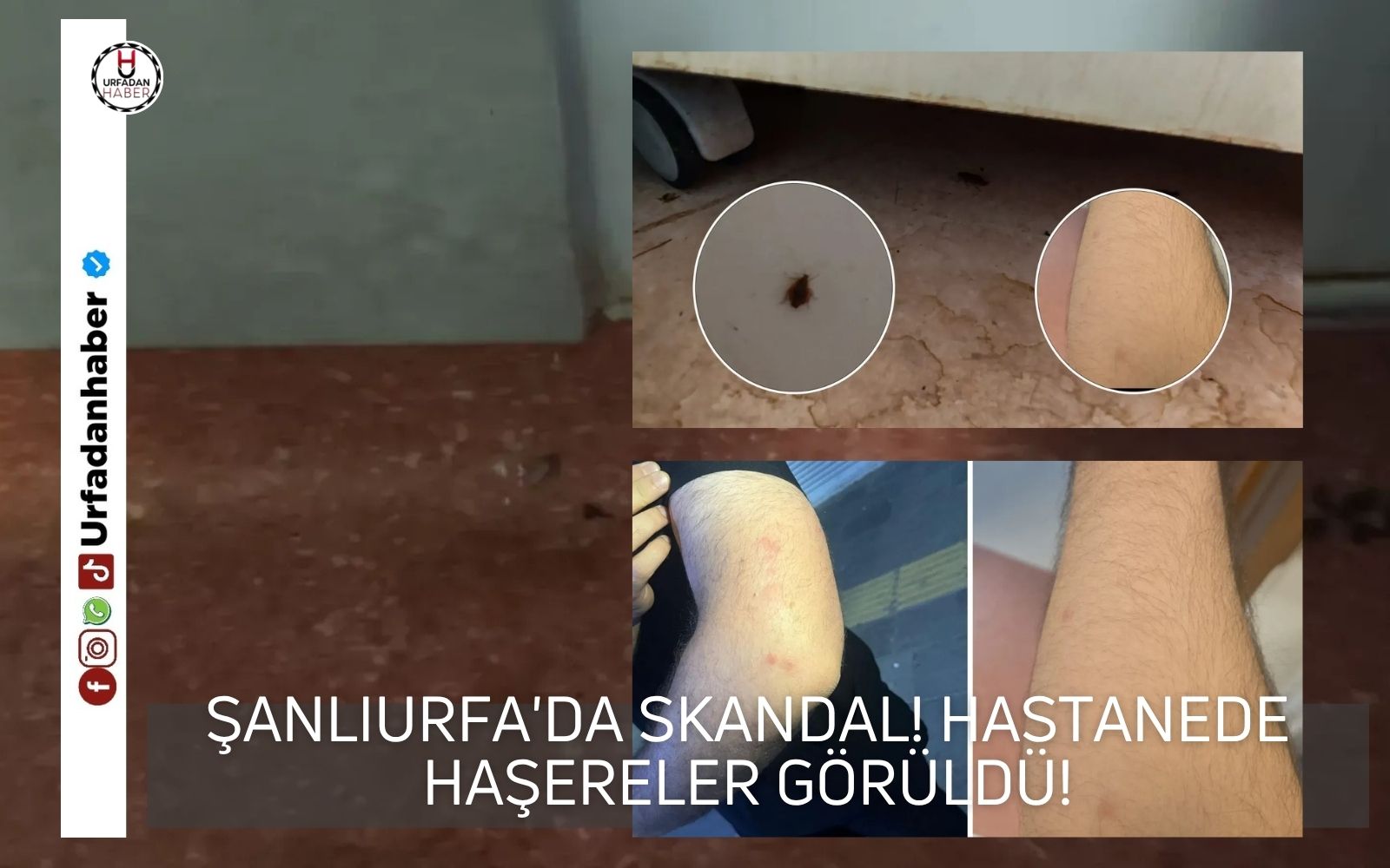 Şanlıurfa'da skandal! Hastanede haşereler görüldü!