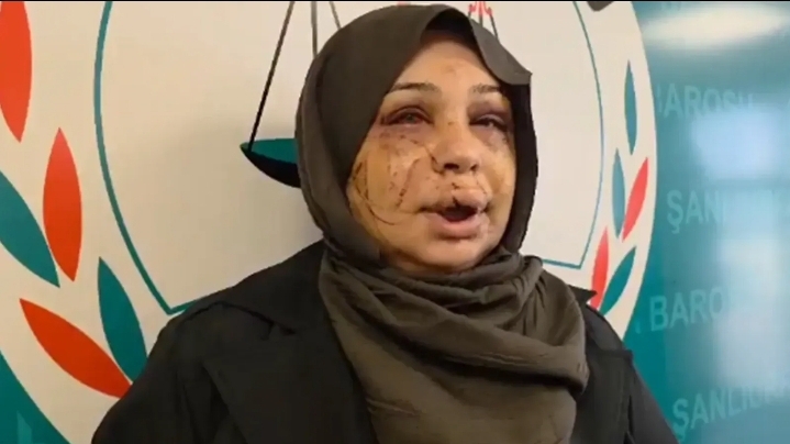 Öldüresiye darp edildi! Urfa Barosu destek verdi!